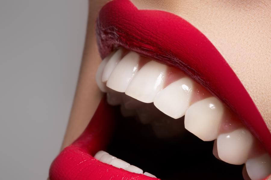 Image of Teeth Whitening